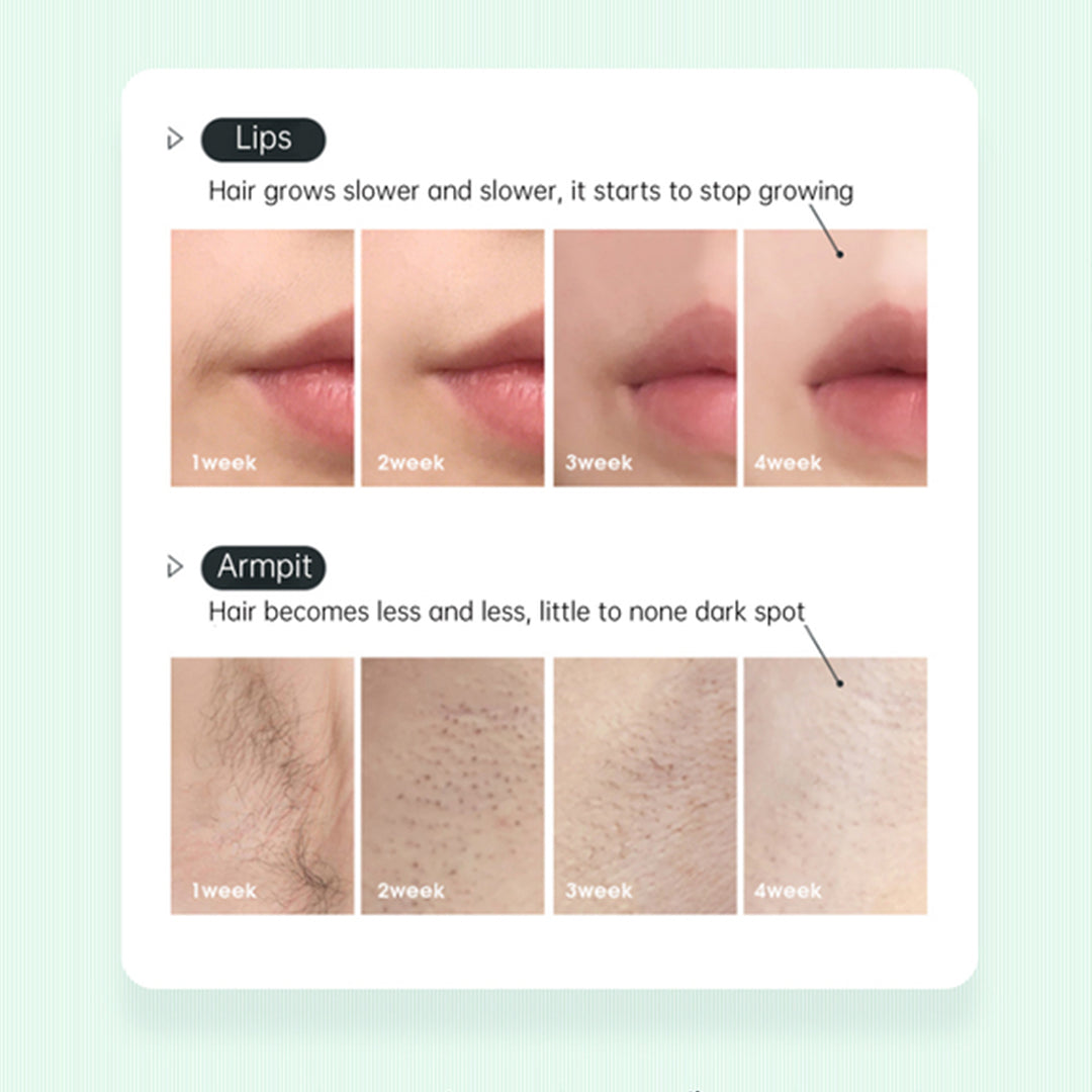 T68S - IPL HAIR REMOVER (ICE COOLING)