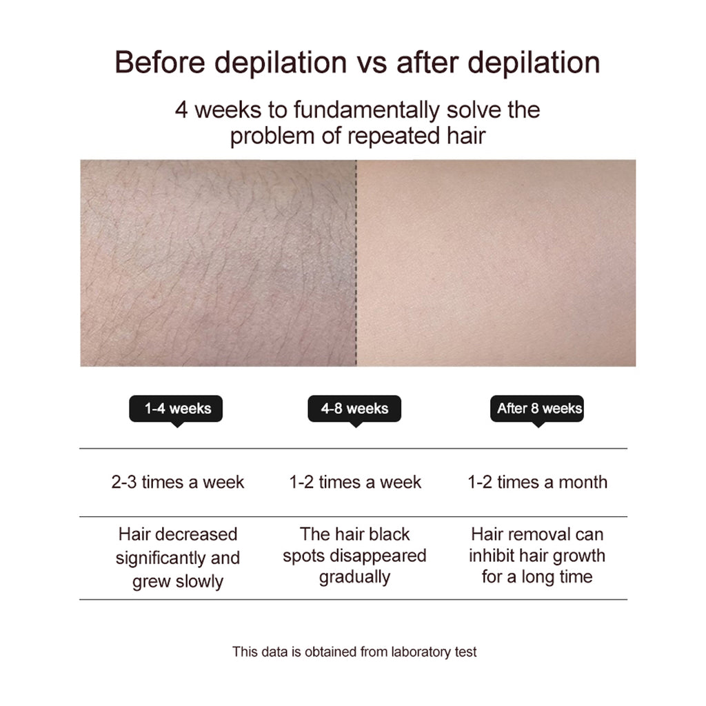 TS5 - IPL HAIR REMOVER (ICE COOLING)