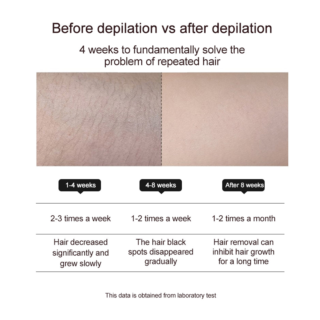 TS5 - IPL HAIR REMOVER (ICE COOLING)