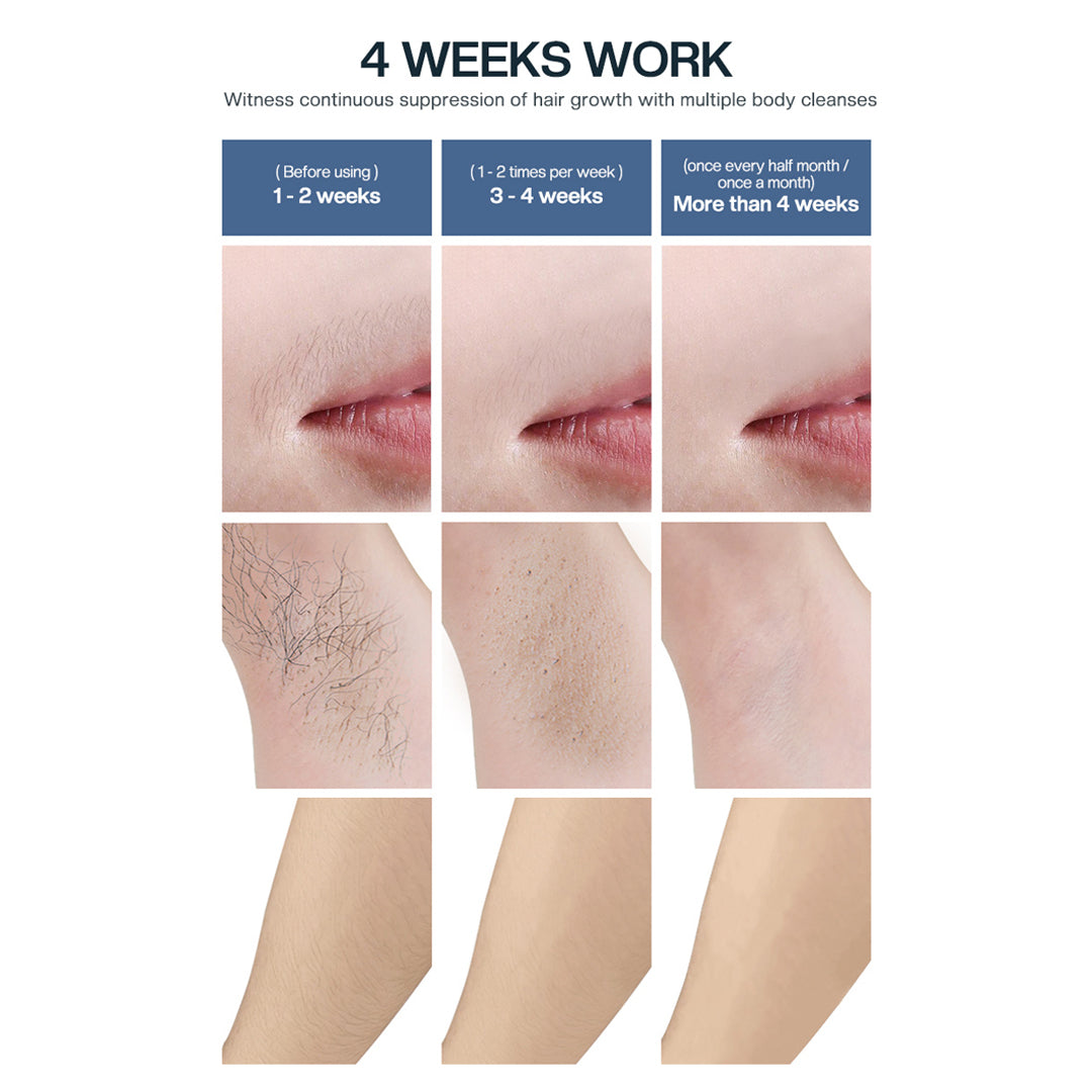 T58S- IPL HAIR REMOVER (ICE COOLNG)